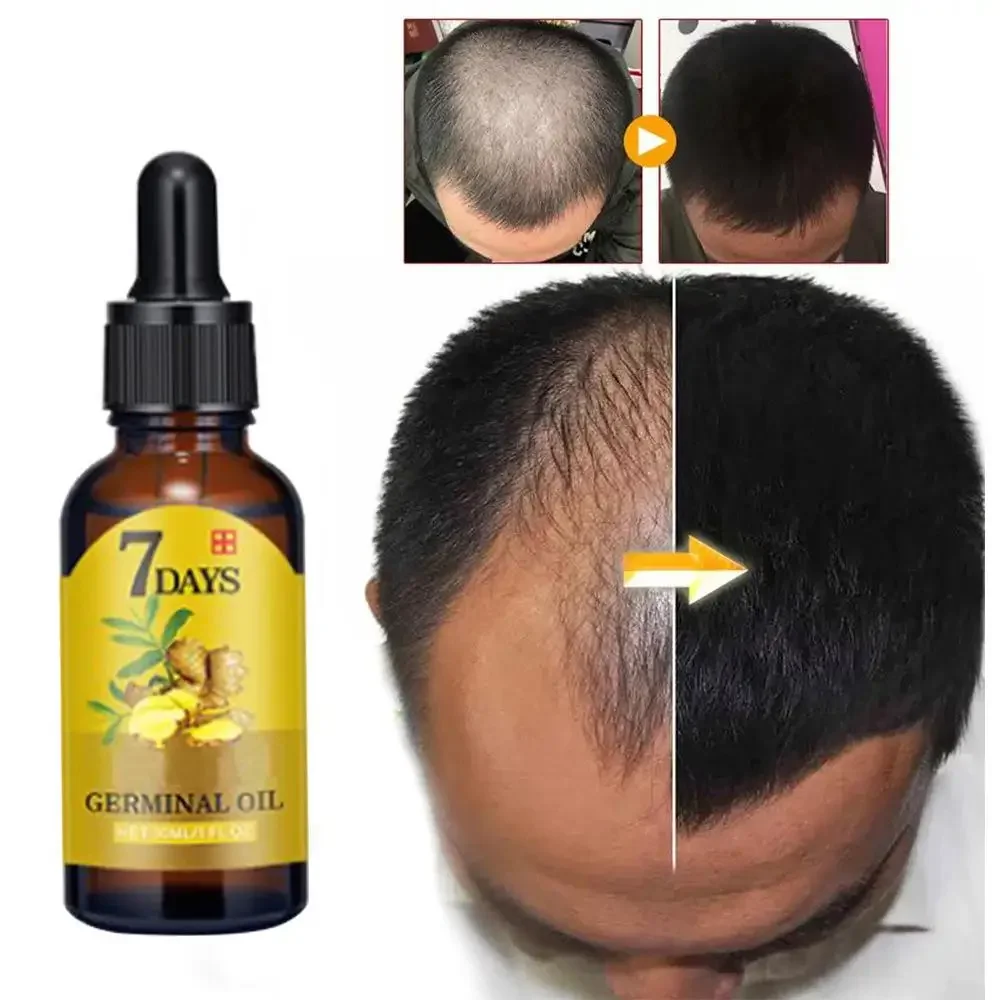Caffeine Hair Serum - Hair Growth Ginger Fast Growing Hair