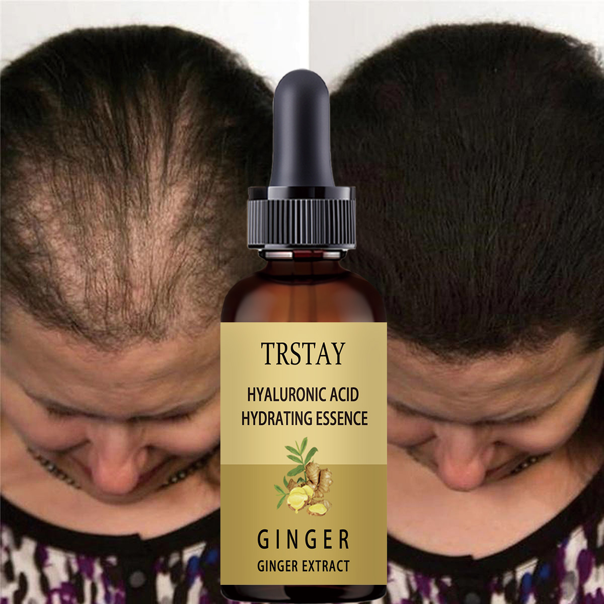 Hair Growth Serum Anti Prevent - Caffeine Hair Serum ulasan dan harga
