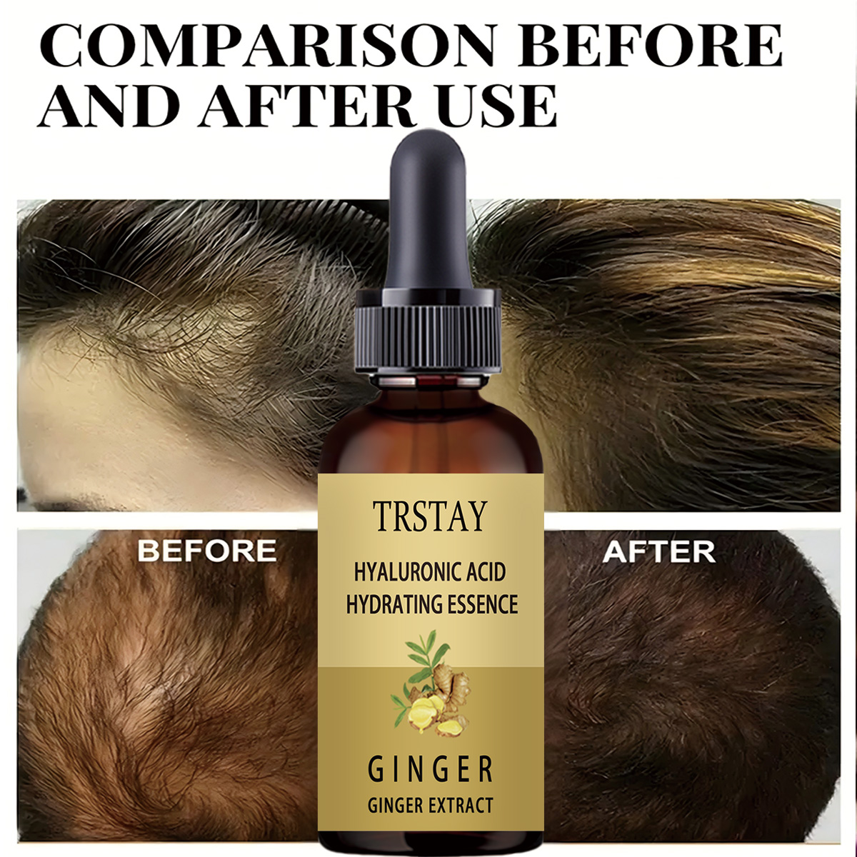 Hair Growth Serum Anti Prevent - Caffeine Hair Serum ulasan dan harga