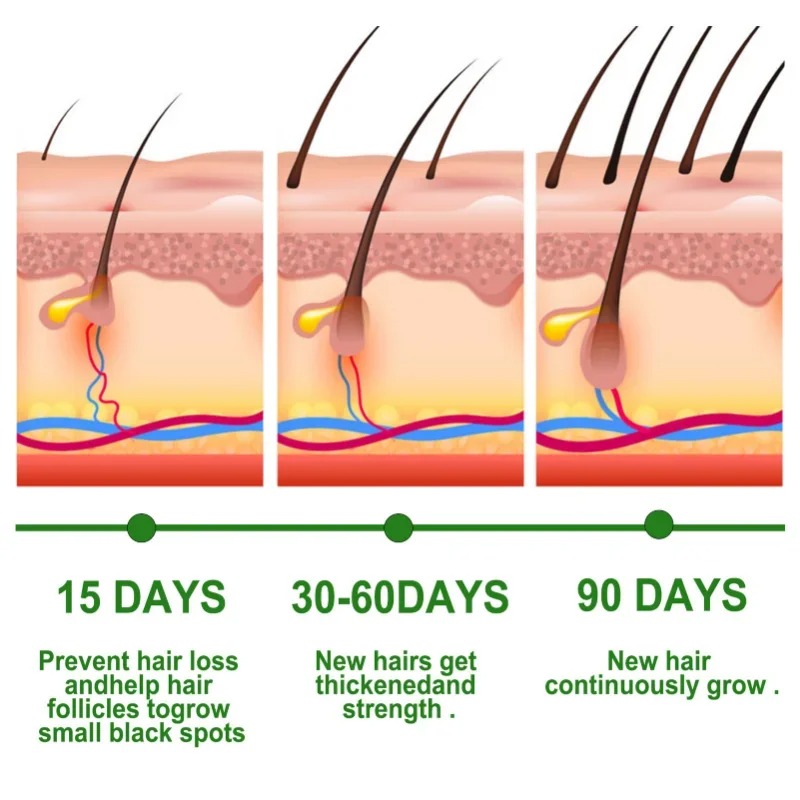 Hair Growth Serum Fast Growing - Caffeine Hair Serum ulasan dan harga