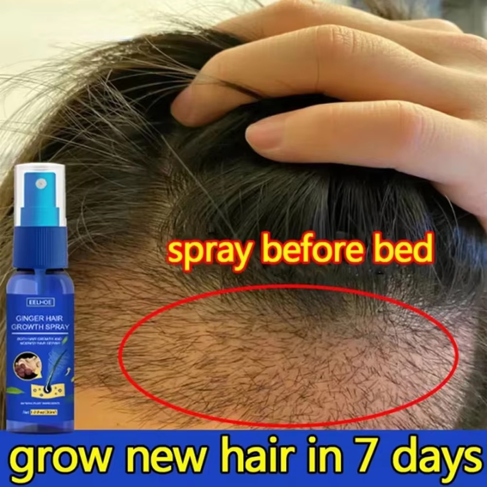 Fast Ginger Hair Growth Spray  - Hair Care Oil Serum ulasan dan harga