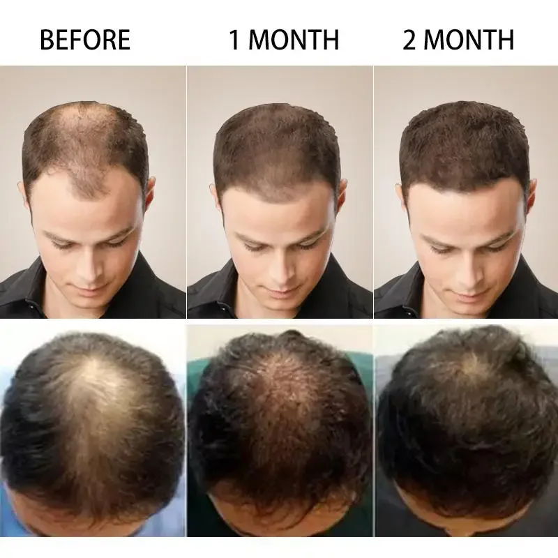 Hair Growth Ginger Fast Growin - Caffeine Hair Serum ulasan dan harga